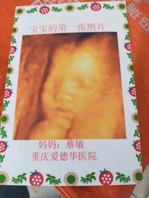 寶寶第一(yī)張照(zhào)片