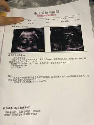 NT歸來(lái),寶寶偏大(dà)一(yī)周