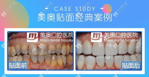 重慶口腔醫(yī)院排名